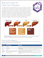 Research_Tools_for_Fatty_Liver_Diseases